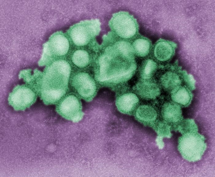 Hình ảnh virus cúm H1N1